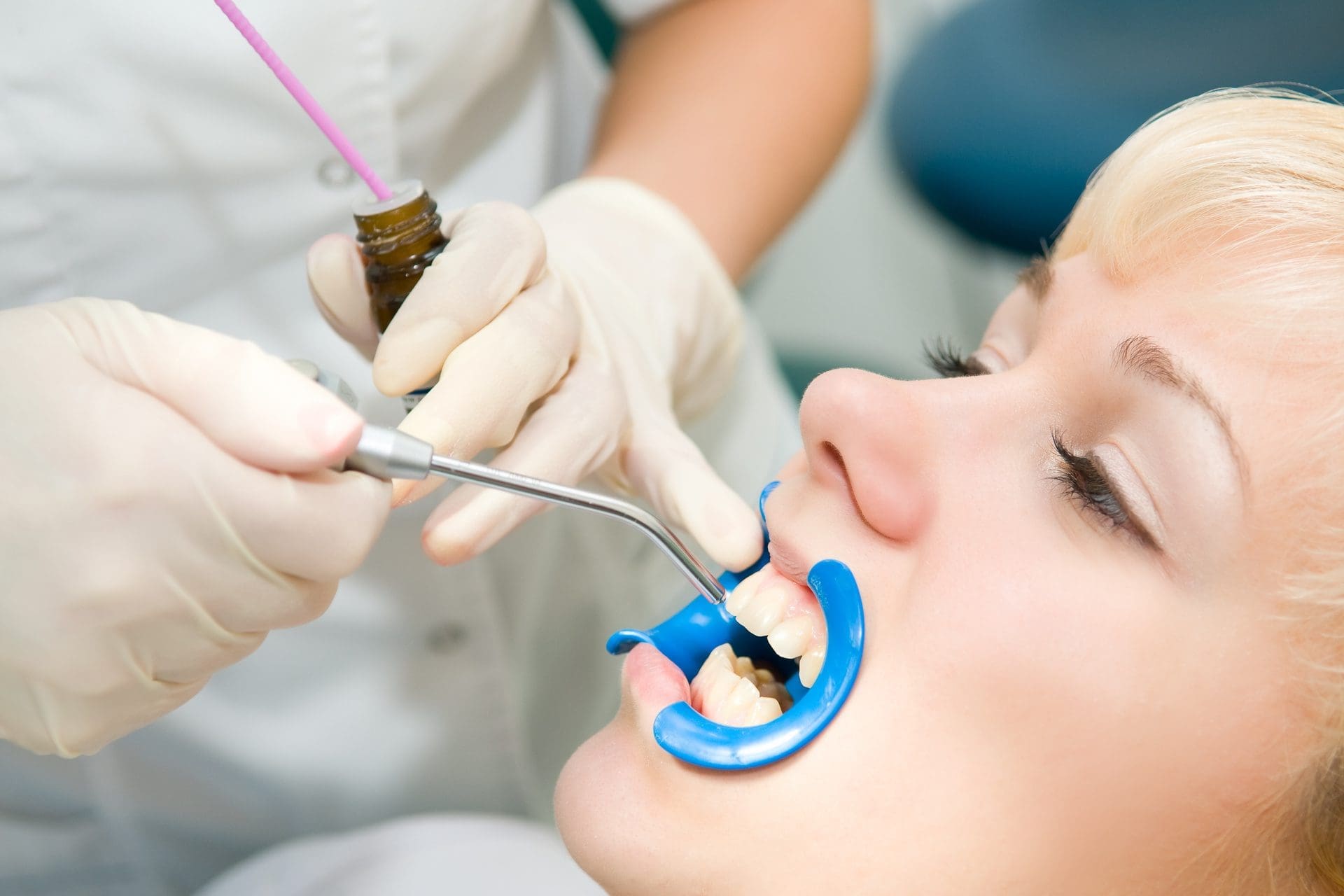 Dental Sealants | General Dentistry - Angstadt Family Dental